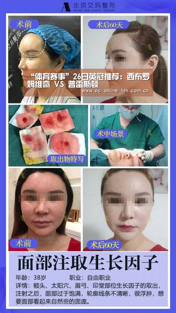 体育赛事